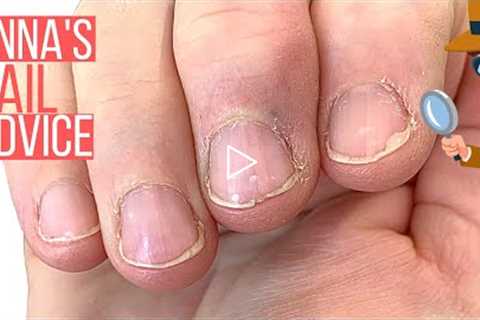 NAIL SHAPE. CAN IT BE CORRECTED? HOW TO TRANSFORM NATURAL NAILS [ANNA'S NAIL ADVICE]