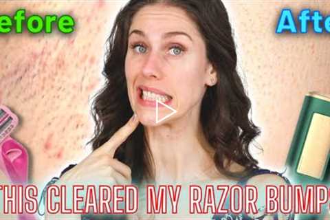 Razor Bumps? Same. Here are ways to deal with underarm pimples and razor burn!