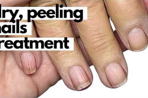 How to effectively condition dry, brittle nails! Start TODAY!!