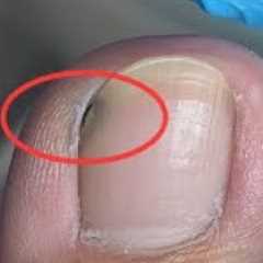 Nails are not cleaned properly and dirt is hidden